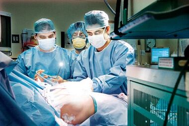 Conducting an surgery to increase a member