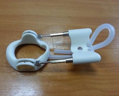 Expander after surgery to increase the member