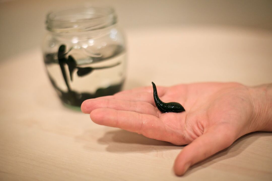 The leeches will serve as raw material for the production of a cream that stimulates the growth of the penis